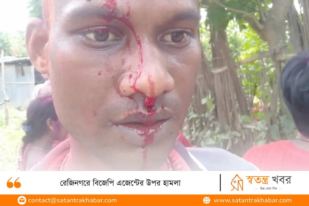 রেজিনগরে বিজেপি এজেন্টের উপর হামলা