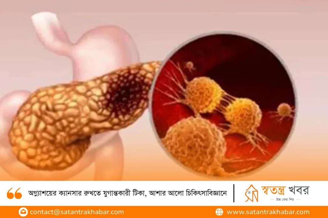 অগ্ন্যাশয়ের ক্যানসার রুখতে যুগান্তকারী টিকা, আশার আলো চিকিৎসাবিজ্ঞানে