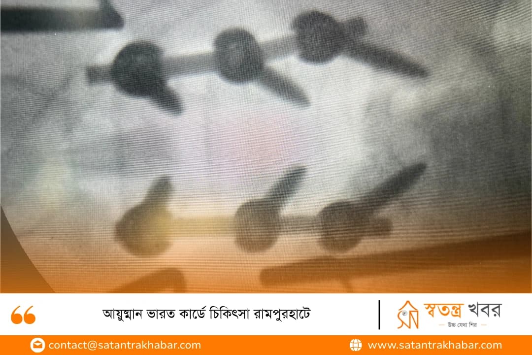 আয়ুষ্মান ভারত কার্ডে চিকিৎসা রামপুরহাটে 