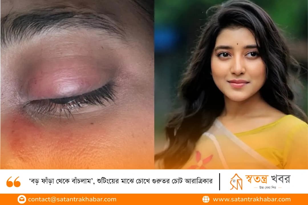 ‘বড় ফাঁড়া থেকে বাঁচলাম’, শুটিংয়ের মাঝে চোখে গুরুতর চোট আরাত্রিকার